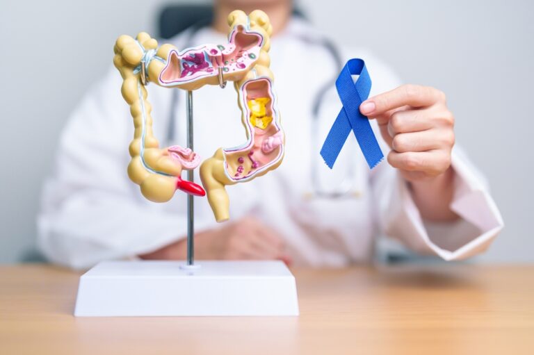 ADH-Colon-Cancer-Screening